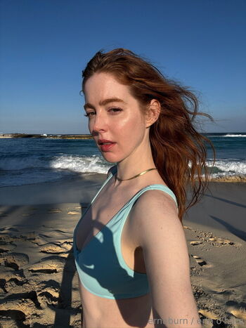 ernaburn